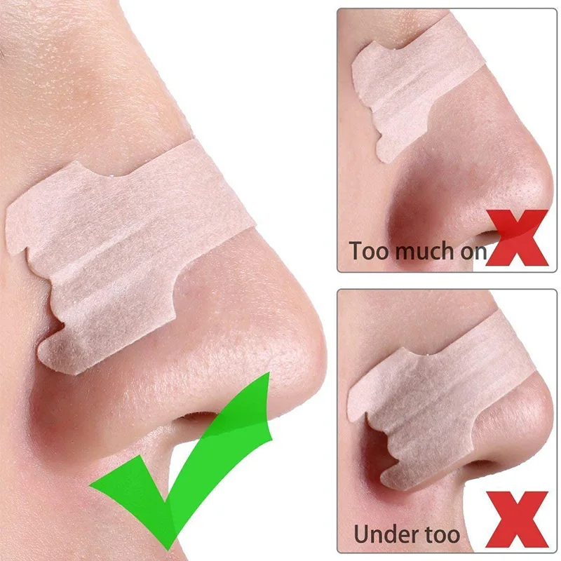 רצועות אף שקופות נגד נחירות להקלה על נשימה